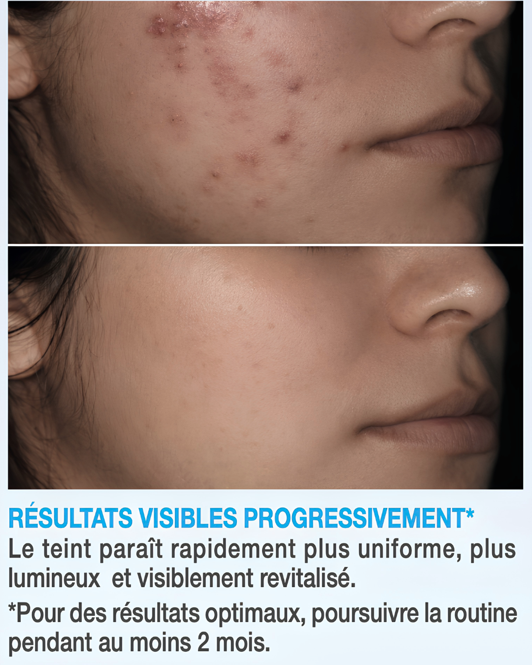 Routine Complète Anti-Taches – 5 Soins Experts Jour &amp; Nuit – Peaux normales à sèches