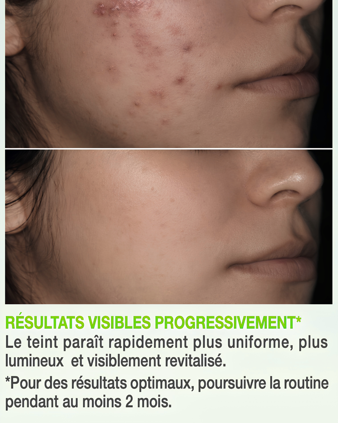 Routine Complète Anti-Taches – 5 Soins Experts Jour &amp; Nuit – Peaux mixtes à grasses